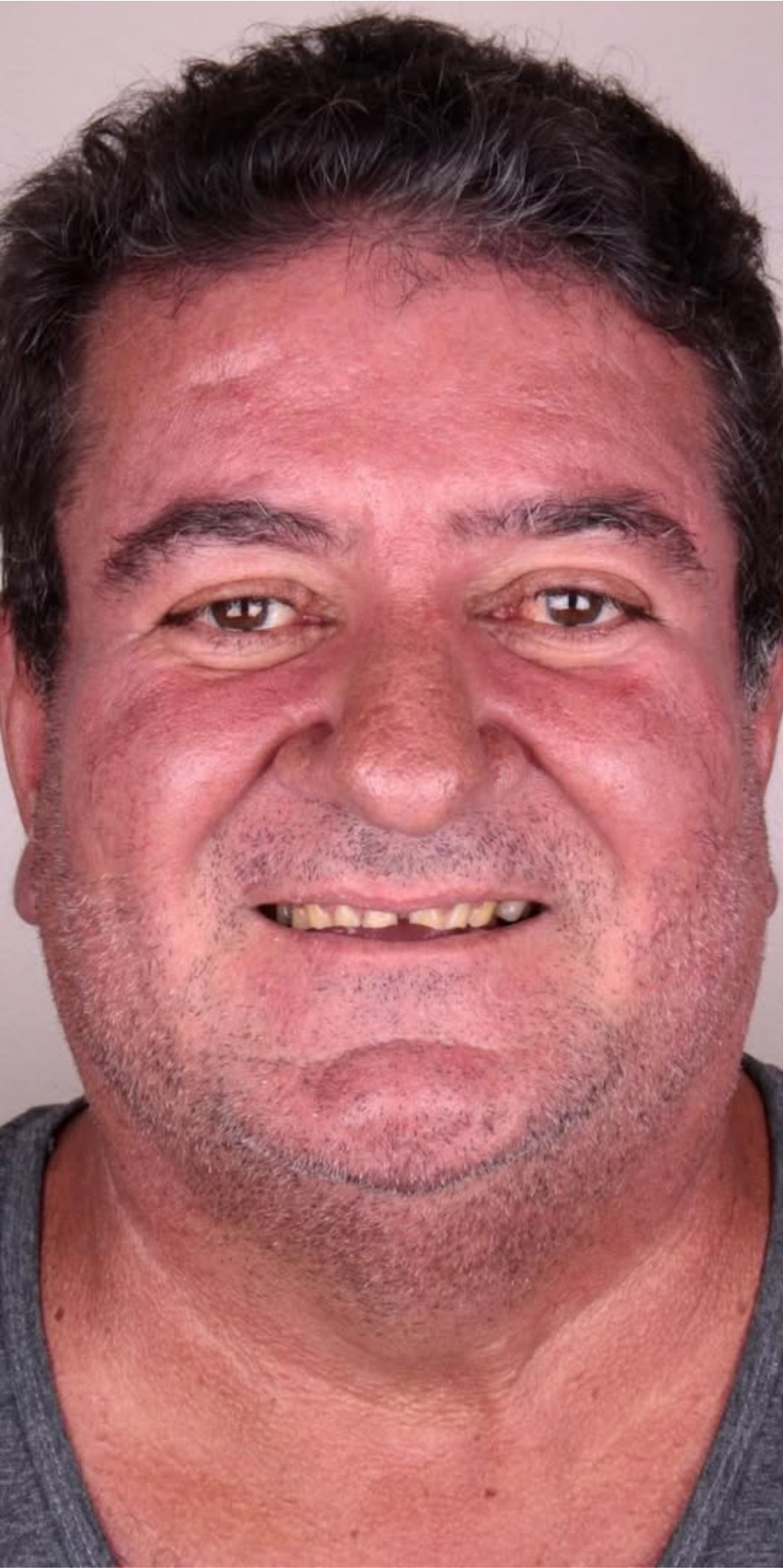 Caso Transformação 05 antes